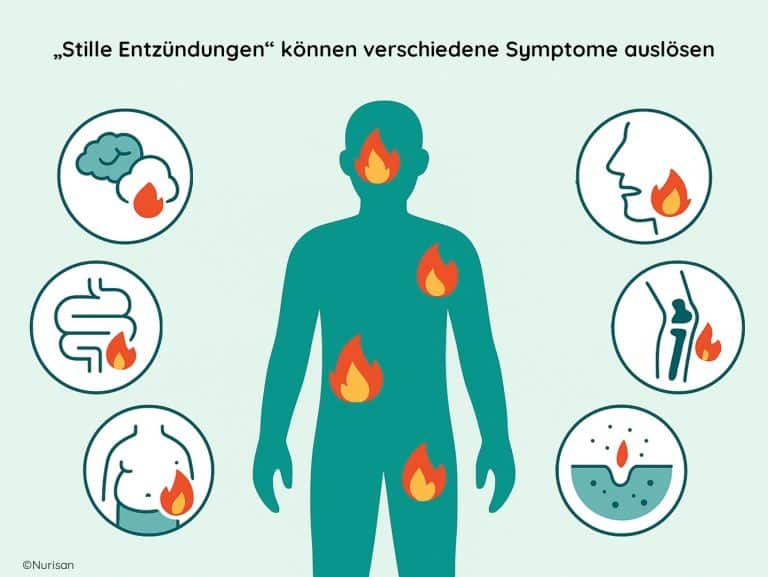 Stille Entzündungen sind chronische, unterschwellige Entzündungsreaktionen im Körper. Sie verlaufen ohne die typischen Symptome wie Rötung oder Schmerz und können über Jahre bestehen. Mögliche Anzeichen sind Müdigkeit, Infektanfälligkeit, Gelenk- und Muskelschmerzen, Verdauungsprobleme sowie ein erhöhtes Risiko für chronische Krankheiten wie Diabetes, Herz-Kreislauf-Erkrankungen oder Krebs. Mögliche Ursachen sind Übergewicht, Stress, Bewegungsmangel, eine unausgewogene Ernährung mit viel Fast Food sowie chronische Entzündungsherde im Mundbereich oder im Darm. Vorbeugen kann man durch eine antientzündliche Ernährung mit viel Gemüse, Omega-3-Fettsäuren und frischen Kräutern, ausreichend Bewegung, Stressbewältigung, guten Schlaf und den Verzicht auf Rauchen und übermäßigen Alkoholkonsum.